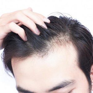 Hair Loss Treatment First Trial